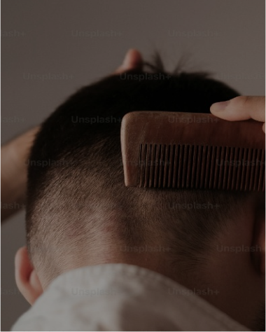hair-fall